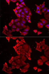 Anti-TIM17 antibody used in Immunocytochemistry/ Immunofluorescence (ICC/IF). GTX16468