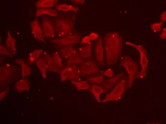Anti-TRPV5 antibody used in Immunocytochemistry/ Immunofluorescence (ICC/IF). GTX16469