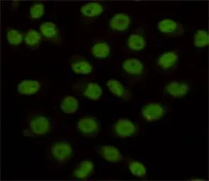 Anti-LSD1 antibody [1E5-H2] used in Immunocytochemistry/ Immunofluorescence (ICC/IF). GTX16471