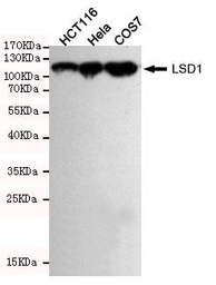 Anti-LSD1 antibody [1E5-H2] used in Western Blot (WB). GTX16471