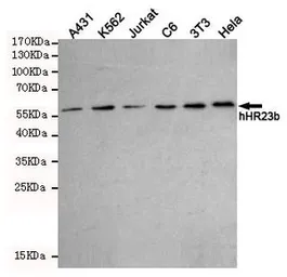 Anti-RAD23B antibody [5H1-A10-A7] used in Western Blot (WB). GTX16485