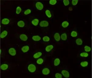 Anti-HP1 gamma antibody [5G10-F7-A12] used in Immunocytochemistry/ Immunofluorescence (ICC/IF). GTX16488