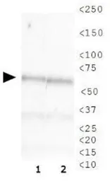 Anti-CHAF1B antibody [SS 24 1-68] used in Western Blot (WB). GTX16494