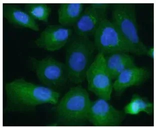 Anti-Aldolase A antibody [AT3F9] used in Immunocytochemistry/ Immunofluorescence (ICC/IF). GTX16497