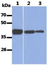 Anti-Aldolase A antibody [AT3F9] used in Western Blot (WB). GTX16497