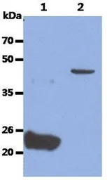 Anti-Glypican 4 antibody [AT51E3] used in Western Blot (WB). GTX16498