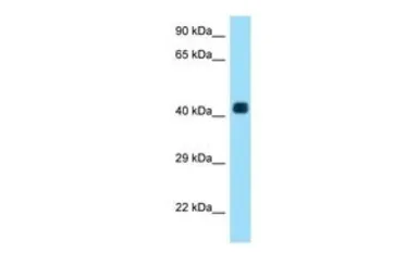 Anti-AADACL3 antibody, C-term used in Western Blot (WB). GTX16548