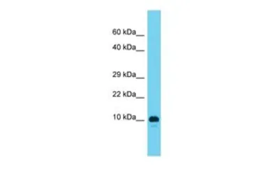 Anti-AAMDC antibody, N-term used in Western Blot (WB). GTX16549
