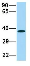 Anti-ABHD17A antibody, C-term used in Western Blot (WB). GTX16552