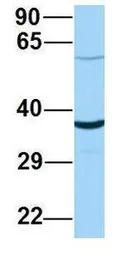 Anti-ABHD17A antibody, C-term used in Western Blot (WB). GTX16552