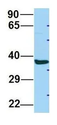 Anti-ABHD17A antibody, C-term used in Western Blot (WB). GTX16552