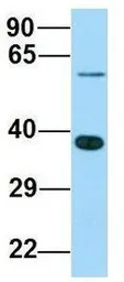 Anti-ABHD17A antibody, C-term used in Western Blot (WB). GTX16552