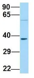 Anti-ABHD17A antibody, C-term used in Western Blot (WB). GTX16552
