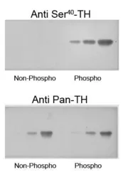 Anti-Tyrosine Hydroxylase (phospho Ser40) antibody used in Western Blot (WB). GTX16557