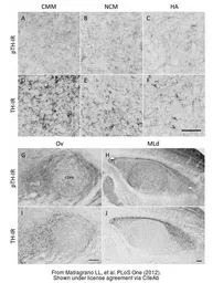 Anti-Tyrosine Hydroxylase (phospho Ser40) antibody used in IHC (Frozen sections) (IHC-Fr). GTX16557