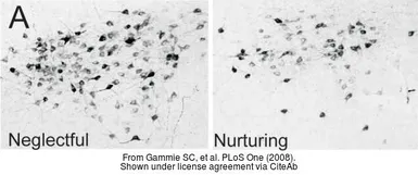 Anti-Tyrosine Hydroxylase (phospho Ser40) antibody used in IHC (Paraffin sections) (IHC-P). GTX16557