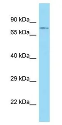 Anti-ACSBG1 antibody, N-term used in Western Blot (WB). GTX16561