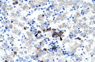 Anti-ABT1 antibody, Internal used in IHC (Paraffin sections) (IHC-P). GTX16577