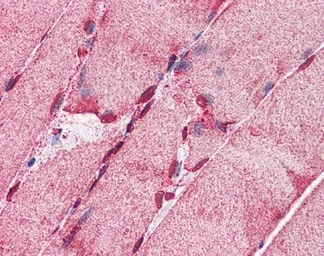 Anti-ACSL5 antibody, C-term used in IHC (Paraffin sections) (IHC-P). GTX16578