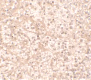 Anti-IL17 Receptor alpha antibody used in IHC (Paraffin sections) (IHC-P). GTX16598