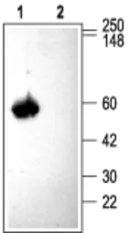 Anti-CACNB3 antibody used in Western Blot (WB). GTX16603