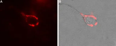Anti-CACNA2D1 antibody used in Live cell imaging (LCI). GTX16607