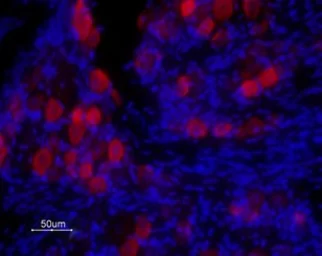 Anti-VR1/ TRPV1 antibody used in IHC (Frozen sections) (IHC-Fr). GTX16609