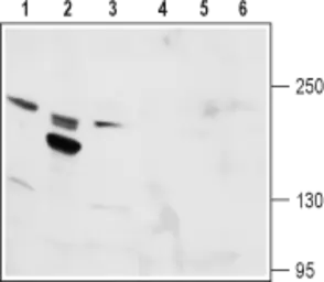 Anti-TRPM6 antibody used in Western Blot (WB). GTX16611