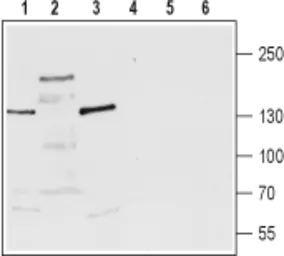 Anti-TRPM3 antibody used in Western Blot (WB). GTX16612