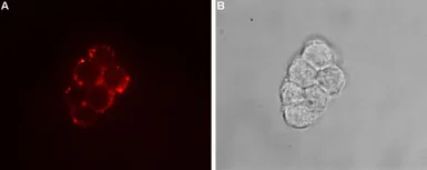 Anti-TRPC7 antibody used in Live cell imaging (LCI). GTX16614