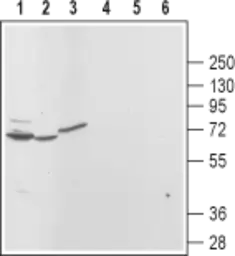 Anti-MCOLN3 antibody used in Western Blot (WB). GTX16617