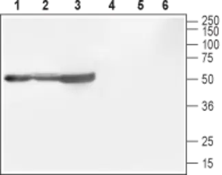 Anti-Cav beta 1 antibody used in Western Blot (WB). GTX16620