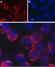 Anti-TRPC6 antibody used in Live cell imaging (LCI). GTX16629