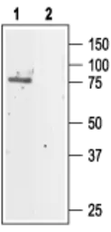 Anti-CLCN5 antibody used in Western Blot (WB). GTX16635