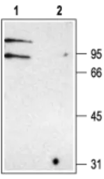 Anti-CLCNKA + CLCNKB antibody used in Western Blot (WB). GTX16636