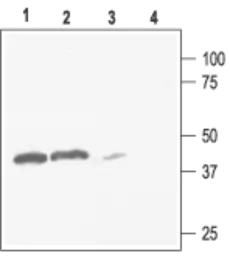 Anti-KIR2.3 antibody used in Western Blot (WB). GTX16644