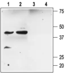 Anti-KCNMB2 antibody used in Western Blot (WB). GTX16645