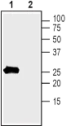 Anti-KCNMB1 antibody used in Western Blot (WB). GTX16646