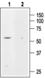 Anti-KCNK5 antibody used in Western Blot (WB). GTX16647