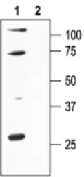 Anti-KCNN1 antibody used in Western Blot (WB). GTX16649