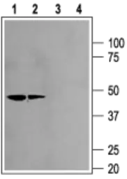Anti-Kir2.2 antibody used in Western Blot (WB). GTX16651