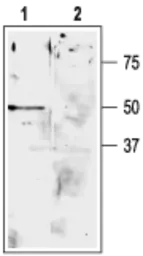 Anti-KCNK9 antibody used in Western Blot (WB). GTX16652