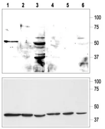 Anti-KCNK9 antibody used in Western Blot (WB). GTX16652