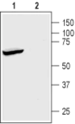 Anti-Trek1 antibody used in Western Blot (WB). GTX16653