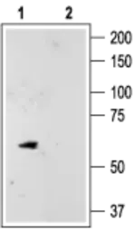 Anti-KCNK10 antibody used in Western Blot (WB). GTX16655