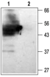 Anti-KCNJ15 antibody used in Western Blot (WB). GTX16664