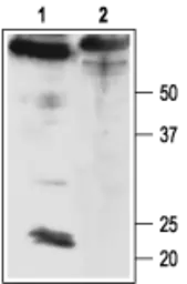 Anti-KCNMB4 antibody used in Western Blot (WB). GTX16666