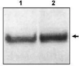 Anti-Dab1 antibody used in Western Blot (WB). GTX16674