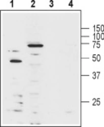 Anti-Kv1.3 antibody (Biotin) used in Western Blot (WB). GTX16679-02