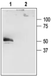 Anti-KCNK4 antibody used in Western Blot (WB). GTX16684